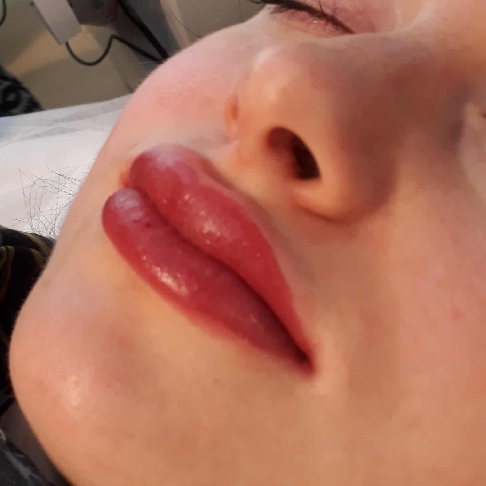 תיחום ומילוי שפתיים בטכניקת הננו